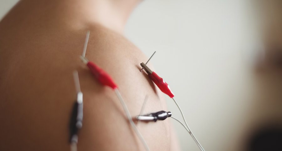Terapia Regenerativa Intratecidular